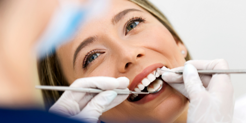 How long will dental veneers last?  