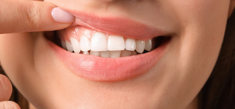 What is Gum Disease? 
