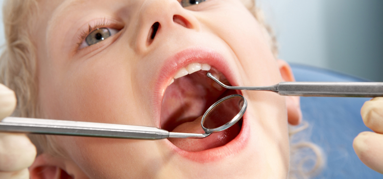 5 Practical Ways to Help Prevent Tooth Decay
