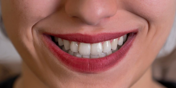 What Causes Translucent Teeth, and How Can You Prevent It?