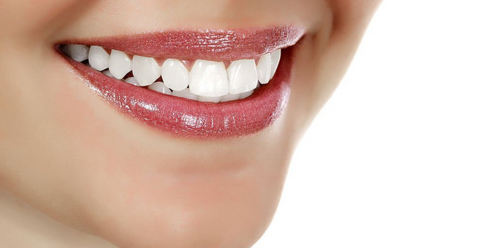 How to Achieve Professional Teeth Whitening Results at Home? 