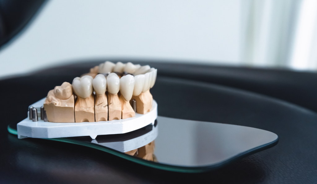 How to Care for Your Zirconia Crowns: Tips and Tricks for Long-Lasting Dental Restorations