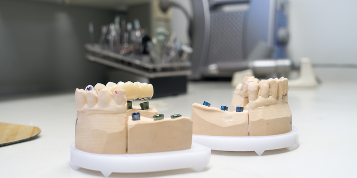 The Role of Zirconia Crowns in Restorative Dentistry Solutions